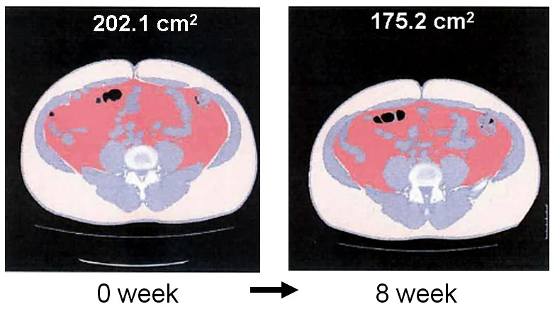 A study of effect of Chalcones from Ashitaba plant on visceral fat