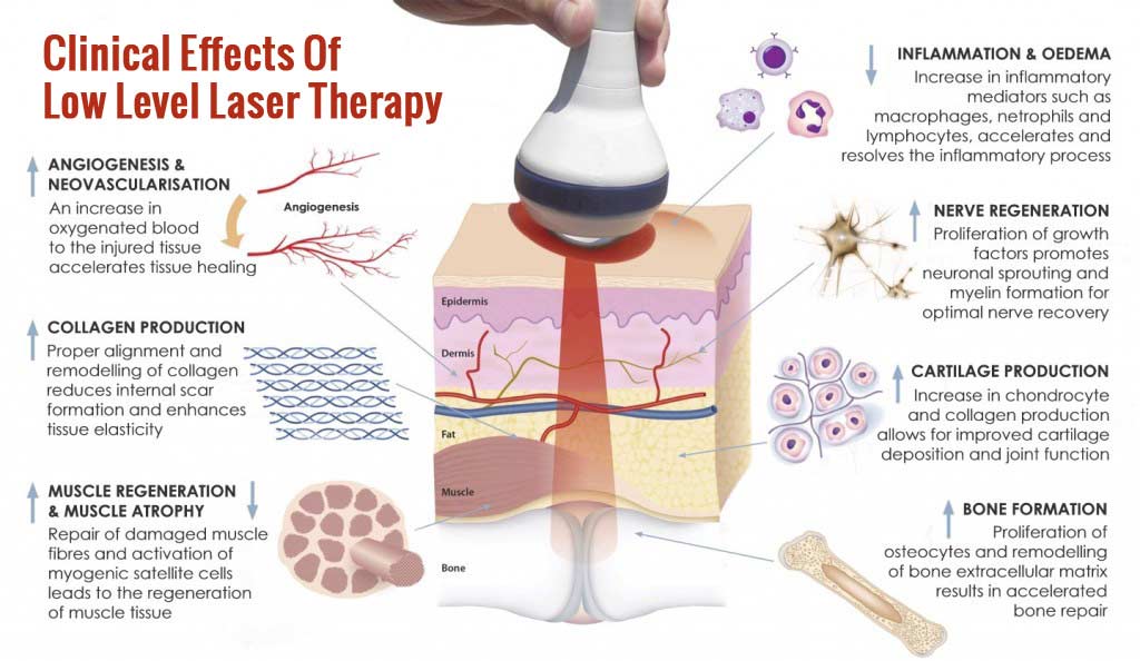 Red light therapy effects