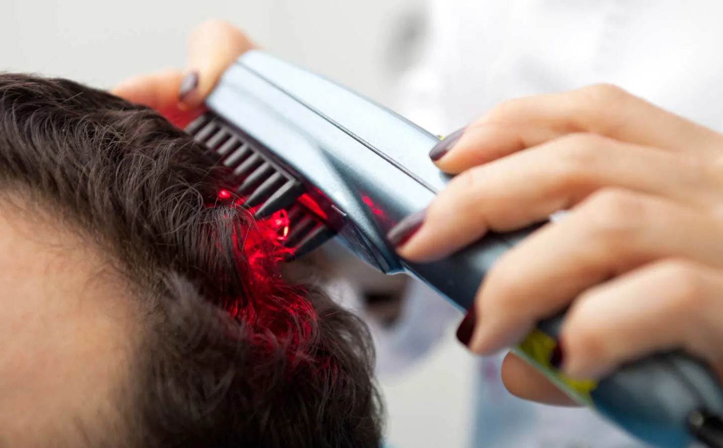 Red light therapy for hair loss